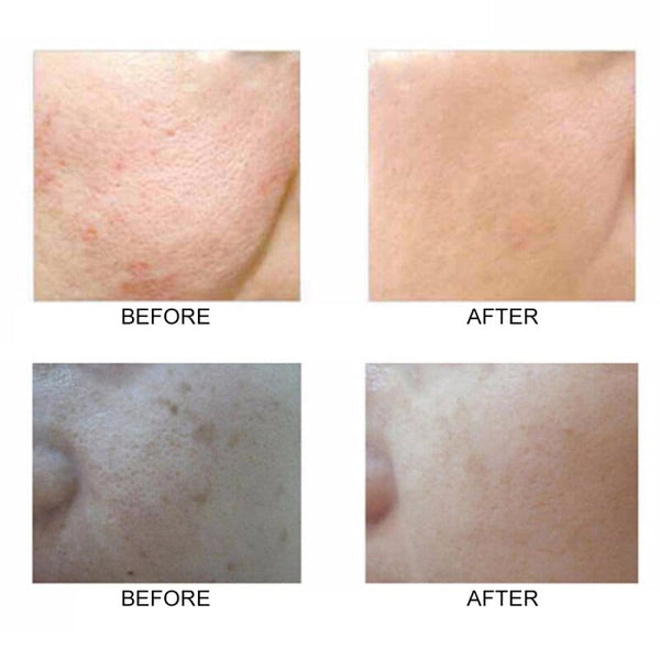 Facial Cleanser Brush